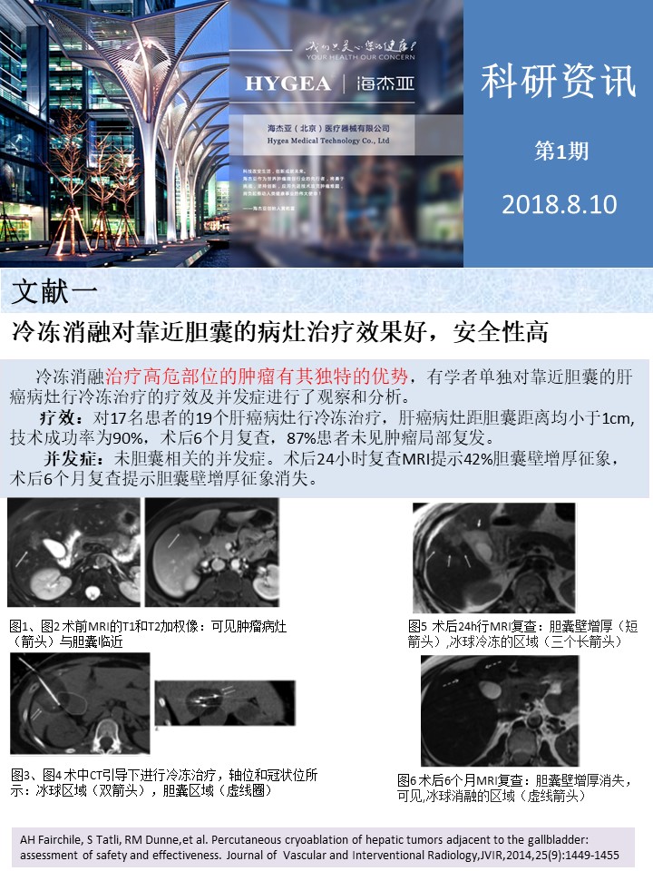 【7790必发集团官网科研资讯】第1期——肝、肺癌消融