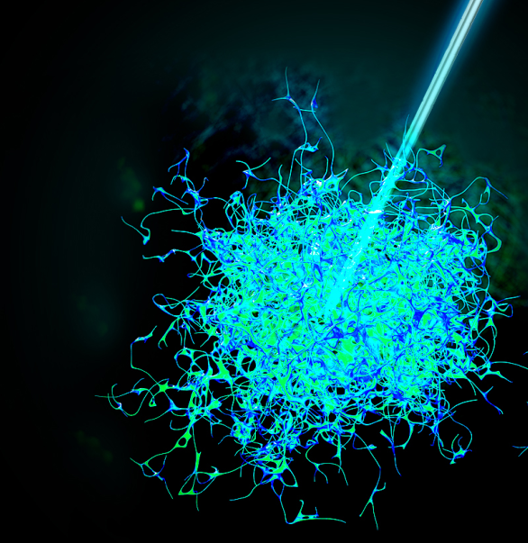 今天，，，，，，我们把肿瘤的内部「融穿」了