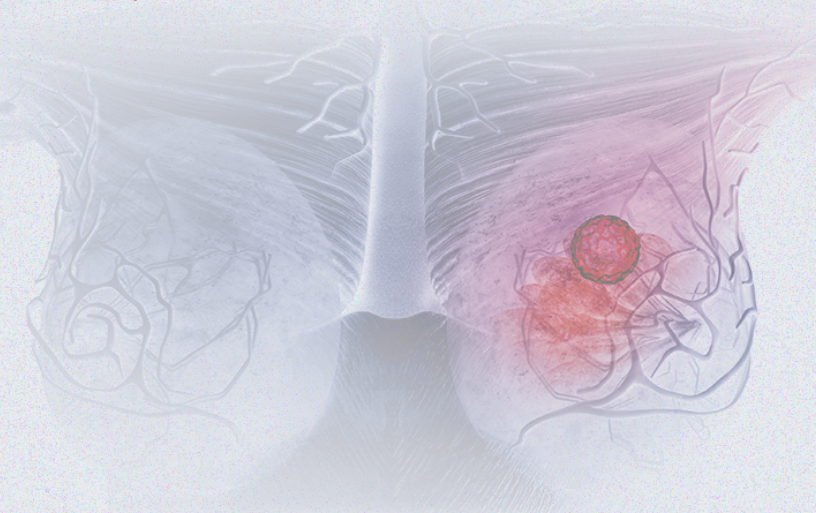 国际妇女节 | 关注乳腺癌 微创染指让俏丽持续，，，，，，「乳」愿以偿正成为现实