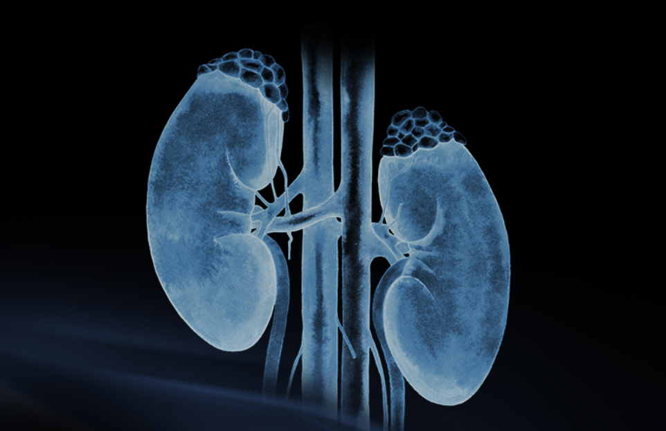 世界肾脏日 | 相得「肾」欢，，，，，，融有术、精准适形